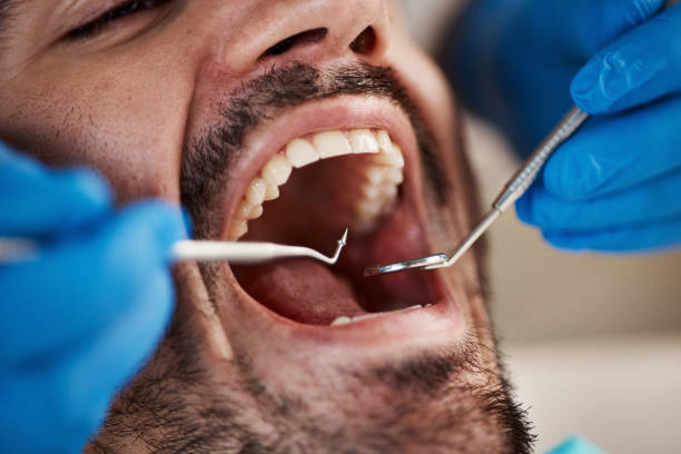 Best Chipped Tooth Repair Near Me  in Barrackville, WV